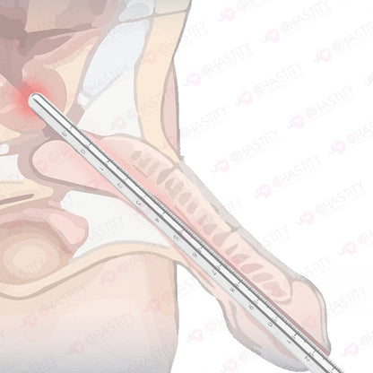 304 Stainless Steel Graduated Long Urethral Sound